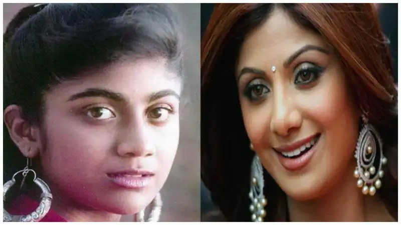 Shilpa Shetty Birthday: शिल्पा शेट्टी के लुक में क्या सर्जरी के बाद आया इतना बदला? तस्वीरें बनी गवाह