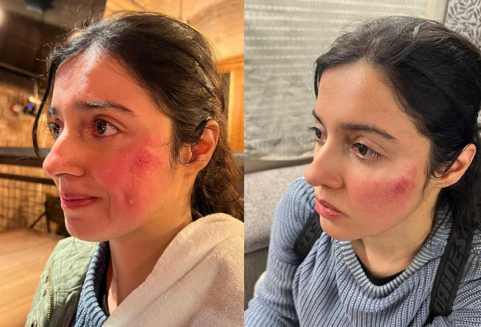'No point of garnering sympathy': Divya Khosla receives trolling in place of 'blessings' as she gets badly injured during Yaariyan 2