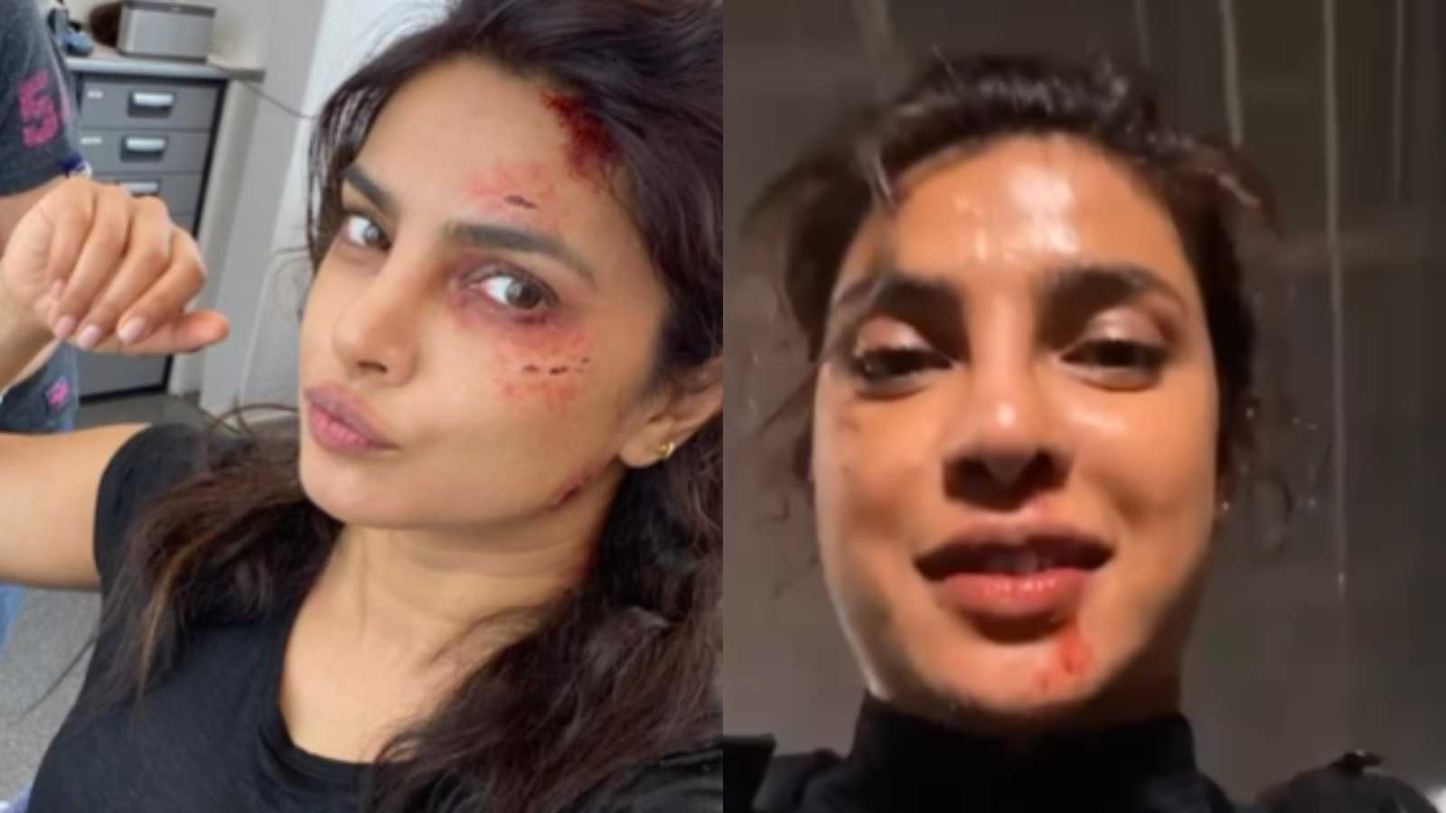 Priyanka Chopra shares glimpse of her 'glamorous' job on the Citadel sets consisting of literal blood, sweat and tears; watch