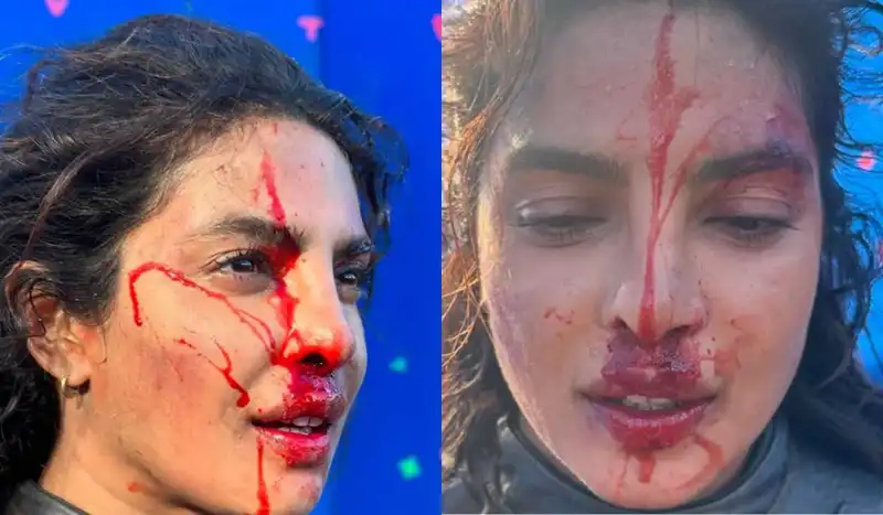 Priyanka Chopra Jonas shares ‘blood-filled’ BTS from her film The Bluff; says, ‘I’m on a film set and it’s all make up!’