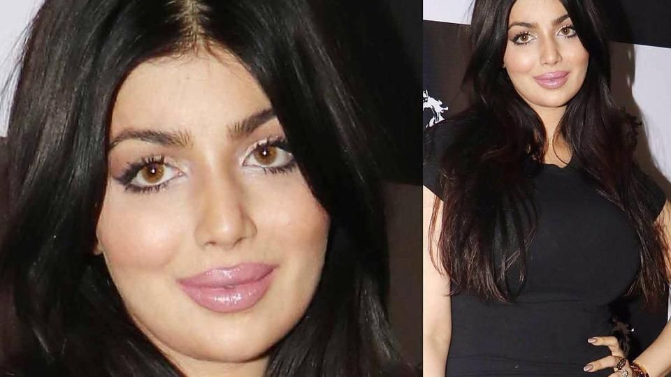 Twitter Trolls Ayesha Takia In The Meanest Possible Way After Her Swollen Face's Pictures Go Viral!