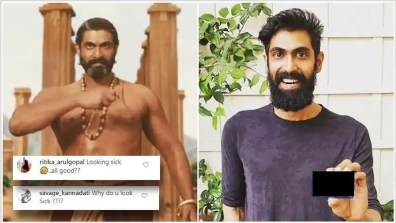 Rana Daggubati’s Dramatic Weight Loss Leaves Fans Concerned: ‘OMG, Are You Okay Dear?’