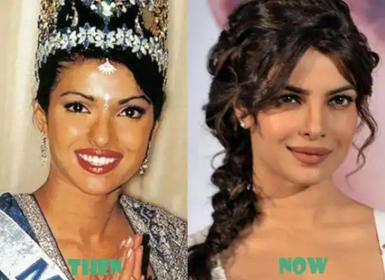 From Bareilly To USA, Priyanka Chopra's Journey In Bollywood! 