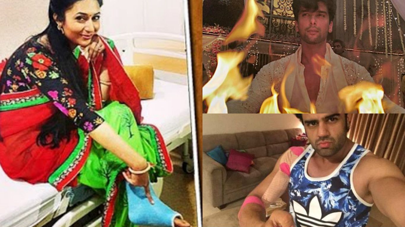 18 TV Celebs Who Injured Themselves During The Shoot Of A Show!