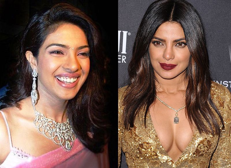 Top 10 Dramatic Transformations Of Bollywood Actresses Post Plastic Surgery