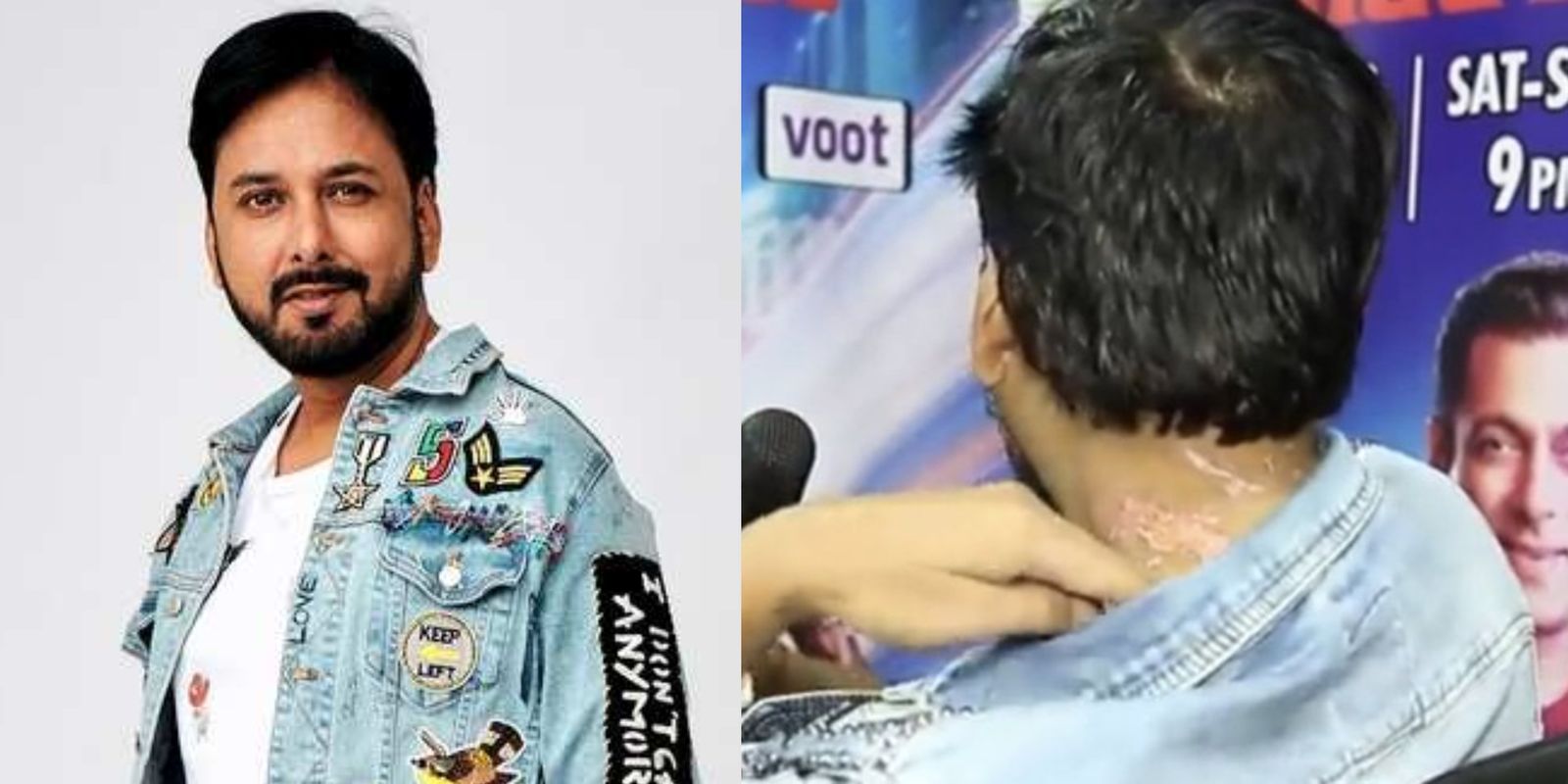 Bigg Boss 13: Siddharth Dey Gets Eliminated, Shows His Wounds After Coming Out Of The House!