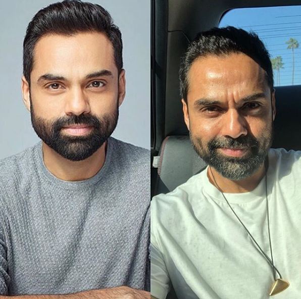 5 Reasons Why We Love Abhay Deol The Man, As Much As We Love Abhay Deol The Actor