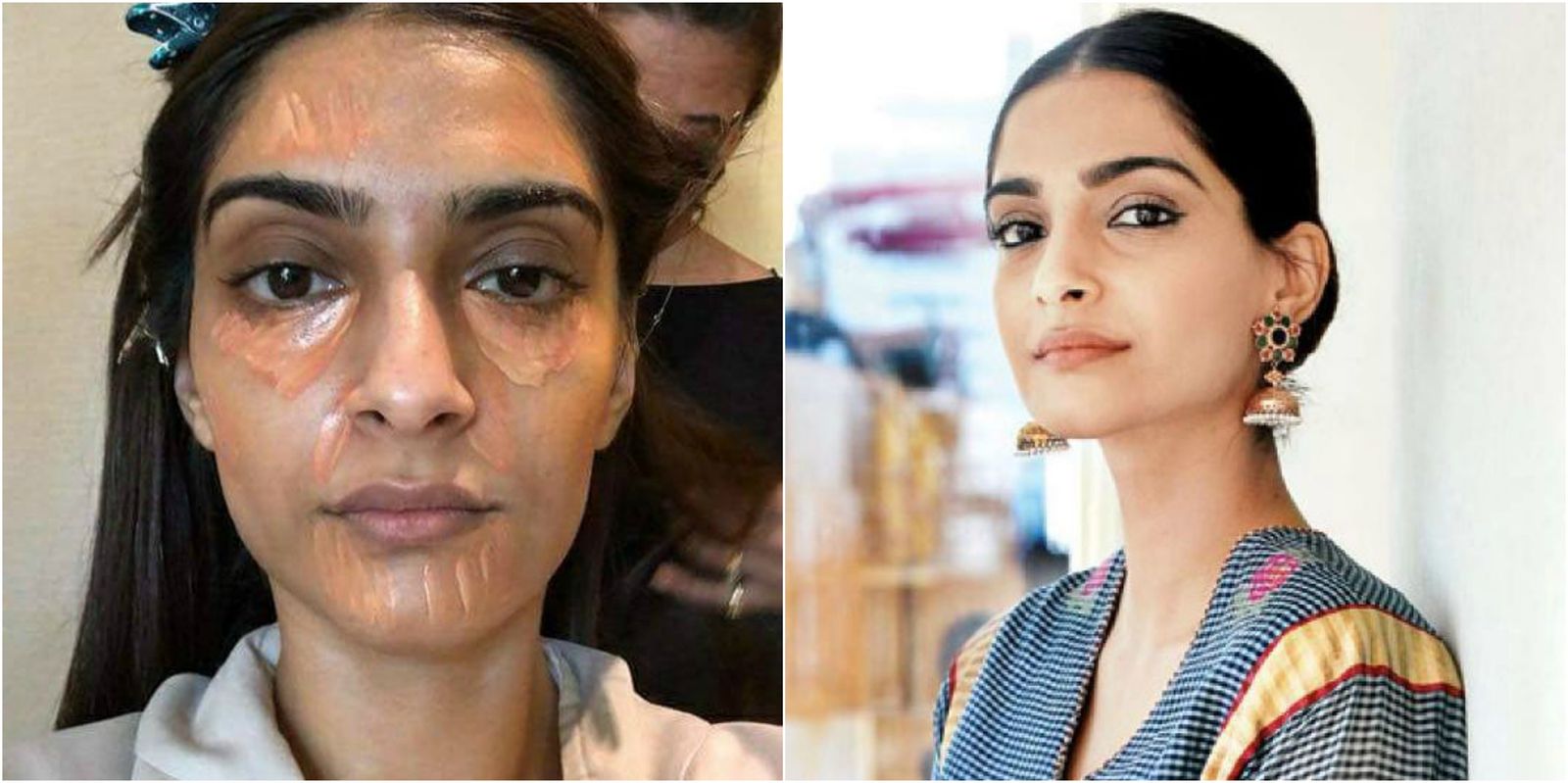 5 Times When Sonam Kapoor Was So Much More Than An Actress Or A Fashionista