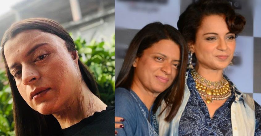 Rangoli Chandel Acid Attack: Kangana's Sister Says She Can 'Never Pay Back' The Actress, Parents Would Faint After Seeing Her Face!