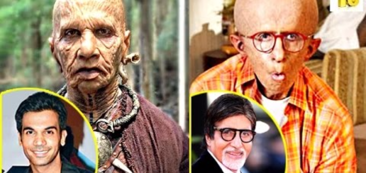 Stars Who Underwent Major Physical Transformations For Their Film Roles!