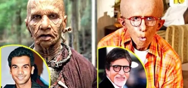 Stars Who Underwent Major Physical Transformations For Their Film Roles!