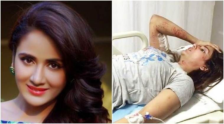 What! Kannada Actor Parul Yadav Will Undergo Surgery After Being Attacked By Dogs
